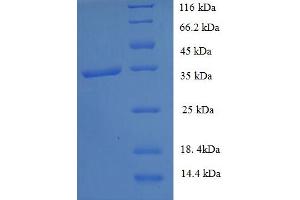 SDS-PAGE (SDS) image for General Transcription Factor IIH, Polypeptide 5 (GTF2H5) (AA 1-71), (full length) protein (GST tag) (ABIN5709629) (GTF2H5 Protein (AA 1-71, full length) (GST tag))