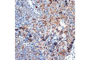 Immunohistochemistry of paraffin-embedded rat spleen using CRMP5/DPYSL5 Rabbit mAb (ABIN7266774) at dilution of 1:100 (40x lens). (DPYSL5 antibody)