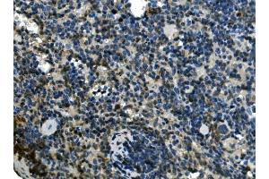 IHC analysis of EIF4A1 using anti-EIF4A1 antibody (ABIN7603125). (EIF4A1 antibody  (N-Term))