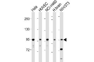 All lanes : Anti-EphA4 Antibody (C-term) at 1:2000 dilution Lane 1: Hela whole cell lysate Lane 2: HUVEC whole cell lysate Lane 3: NCI- whole cell lysate Lane 4: Human brain tissue lysate Lane 5: NIH/3T3 whole cell lysate Lysates/proteins at 20 μg per lane. (EPH Receptor A4 antibody  (C-Term))