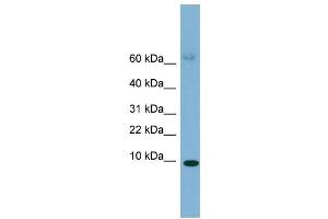 WB Suggested Anti-SAA4 Antibody Titration:  0. (SAA4 antibody  (Middle Region))