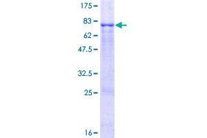 Image no. 1 for Protein tyrosine Phosphatase, Non-Receptor Type 1 (PTPN1) (AA 1-435) protein (GST tag) (ABIN1316816)