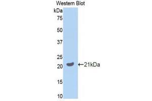 Western Blotting (WB) image for anti-Growth Arrest-Specific 6 (GAS6) (AA 483-646) antibody (ABIN3209083)