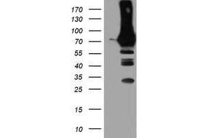 Western Blotting (WB) image for anti-phosphofructokinase, Platelet (PFKP) antibody (ABIN1500164)