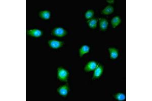 Immunofluorescent analysis of A549 cells using ABIN7163630 at dilution of 1:100 and Alexa Fluor 488-congugated AffiniPure Goat Anti-Rabbit IgG(H+L) (PDGFRB antibody  (AA 901-1106))