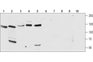 Western blot analysis of rat lung (lanes 1 and 6), rat brain (lanes 2 and 7), mouse brain (lanes 3 and 8), rat heart (lanes 4 and 9) and mouse heart (lanes 5 and 10) lysates:1-5.