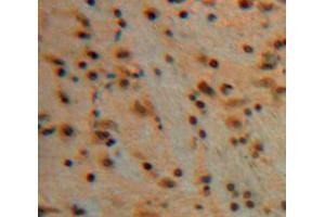 Used in DAB staining on fromalin fixed paraffin-embedded Brain tissue (Erythrocyte Ankyrin antibody  (AA 32-369))