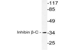 Western blot (WB) analysis of Inhibin beta-C antibody in extracts from A549 cells. (INHBC antibody)