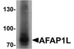 Western blot analysis of AFAP1L1 in A549 cell lysate with AFAP1L1 Cat.