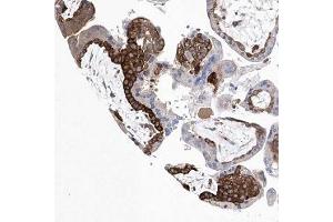 Immunohistochemical staining of human placenta with C14orf100 polyclonal antibody ( Cat # PAB28315 ) shows strong cytoplasmic positivity in trophoblastic cells.