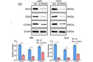 Downregulation of SKA3 affects the cell cycle in HCC cells. (SKA3 antibody  (AA 201-300))