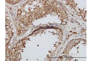 Immunoperoxidase of monoclonal antibody to PIP5K3 on formalin-fixed paraffin-embedded human testis. (PIKFYVE antibody  (AA 342-451))