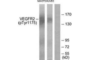 Western blot analysis of extracts from HuvEc cells and NIH/3T3 cells, using VEGFR2 (Phospho-Tyr1175) Antibody. (VEGFR2/CD309 antibody  (pTyr1175))