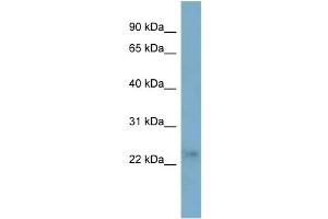 WB Suggested Anti-FTHL17 Antibody Titration:  0. (FTHL17 antibody  (Middle Region))