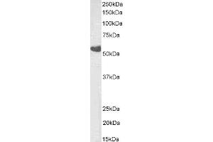 ABIN4902780 (0. (TBXA2R antibody  (Isoform beta))