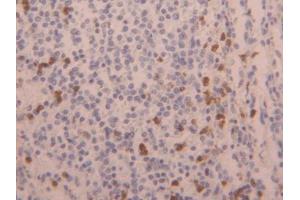 DAB staining on IHC-P; Samples: Human Spleen Tissue (LAMC3 antibody  (AA 1250-1418))