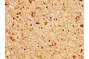 IHC image of ABIN7158074 diluted at 1:100 and staining in paraffin-embedded human brain tissue performed on a Leica BondTM system. (LGI2 antibody  (AA 194-310))