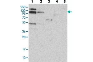Western blot analysis of Lane 1: RT-4, Lane 2: U-251 MG, Lane 3: Human Plasma, Lane 4: Liver, Lane 5: Tonsil with RBM15B polyclonal antibody  at 1:250-1:500 dilution. (RBM15B antibody)