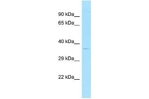 WB Suggested Anti-ATXN7L3 Antibody Titration: 1. (ATXN7L3 antibody  (Middle Region))