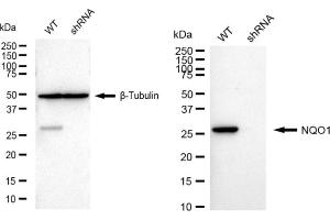 Western blotting analysis using NQO1 antibody (ABIN7800954).
