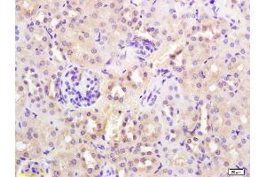 Formalin-fixed and paraffin embedded mouse kidney labeled with Rabbit Anti SYVN1/HRD1 Polyclonal Antibody, Unconjugated (ABIN671811) at 1:200 followed by conjugation to the secondary antibody and DAB staining (SYVN1 antibody  (AA 531-617))