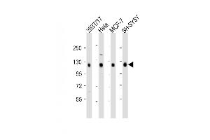 All lanes : Anti-DLG1 Antibody (Center) at 1:2000 dilution Lane 1: 293T/17 whole cell lysate Lane 2: Hela whole cell lysate Lane 3: MCF-7 whole cell lysate Lane 4: SH-SY5Y whole cell lysate Lysates/proteins at 20 μg per lane. (DLG1 antibody  (AA 643-673))