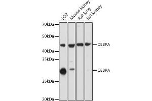 Western blot analysis of extracts of various cell lines, using CEBPA antibody ( ABIN6131380, ABIN6138380, ABIN6138381 and ABIN6214018) at 1:1000 dilution. (CEBPA antibody  (AA 1-205))
