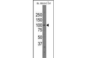 Western blot analysis of anti-Parp12 Pab (R) in mouse muscle tissue lysates (35 μg/lane). (PARP12 antibody  (C-Term))