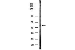 anti-5'-Nucleotidase, Cytosolic IA (NT5C1A) (Internal Region) antibody
