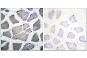 Immunohistochemical analysis of paraffin-embedded human skeletal muscle tissue, using Bak antibody (ABIN5976349).