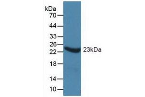 Figure. (ORM1 antibody  (AA 19-201))