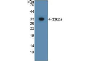 Western blot analysis of recombinant Mouse GPC3. (Glypican 3 antibody  (AA 344-559))