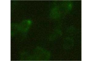 293 cells transfected with C-terminal HA tag protein.