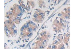 IHC-P analysis of Human Stomach Tissue, with DAB staining. (SYNE1 antibody  (AA 30-283))