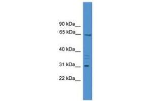 Image no. 1 for anti-Matrix Extracellular phosphoglycoprotein (MEPE) (AA 350-399) antibody (ABIN6745445) (MEPE antibody  (AA 350-399))