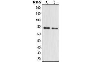 Western blot analysis of MPP10 expression in HeLa (A), MCF7 (B) whole cell lysates. (MPHOSPH10 antibody  (Center))