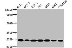 Western Blot Positive WB detected in: Hela whole cell lysate, MCF-7 whole cell lysate, THP-1 whole cell lysate, 293 whole cell lysate, A549 whole cell lysate, K562 whole cell lysate, Colo320 whole cell lysate All lanes: BAK1 antibody at 0. (Recombinant BAK1 antibody)