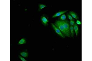 Immunofluorescence staining of A549 cells with ABIN7169337 at 1:150, counter-stained with DAPI. (SERPINB3 antibody  (AA 2-383))