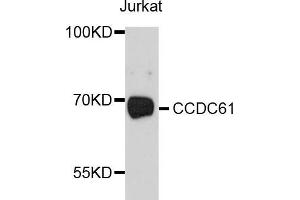 Western blot analysis of extracts of Jurkat cells, using CCDC61 antibody (ABIN5997378) at 1/1000 dilution. (CCDC61 antibody)