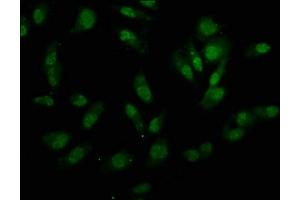 Immunofluorescence staining of Hela cells with ABIN7155342 at 1:133, counter-stained with DAPI. (UTY antibody  (AA 1-72))