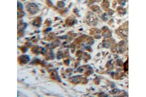 Used in DAB staining on fromalin fixed paraffin-embedded Pancreas tissue (LEFTY1 antibody  (AA 43-364))