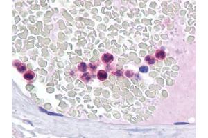 Immunohistochemistry (IHC) image for anti-Interferon Regulatory Factor 4 (IRF4) (AA 342-452) antibody (ABIN614626) (IRF4 antibody  (AA 342-452))