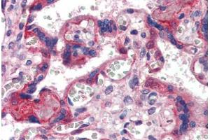 Placenta, Human: Formalin-Fixed, Paraffin-Embedded (FFPE) (COL6 antibody)
