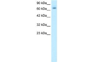 WB Suggested Anti-PAntibody Titration:  0. (PARP2 antibody  (Middle Region))