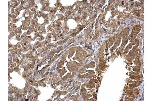IHC-P Image Dishevelled 3 antibody [N1N2], N-term detects Dishevelled 3 protein at cytoplasm on mouse lung by immunohistochemical analysis. (DVL3 antibody  (N-Term))