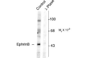 Western blots of rat testes lysate showing specific immunolabeling of the ~46k EphrinB phosphorylated at Tyr331 (Control). (EPH Receptor B2 antibody  (pTyr331))