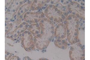 IHC-P analysis of Rat Kidney Tissue, with DAB staining. (Paxillin antibody  (AA 327-568))