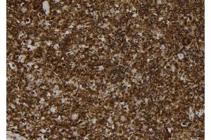 ABIN6272924 at 1/100 staining Mouse spleen tissue by IHC-P. (MAT2B antibody  (Internal Region))