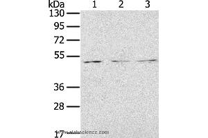 Western blot analysis of Jurkat, K562 and 293T cell, using FOXG1  Polyclonal Antibody at dilution of 1:200 (FOXG1 antibody)