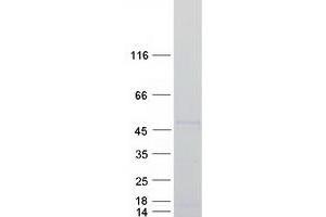 RUNX1 Protein (Transcript Variant 2) (Myc-DYKDDDDK Tag)